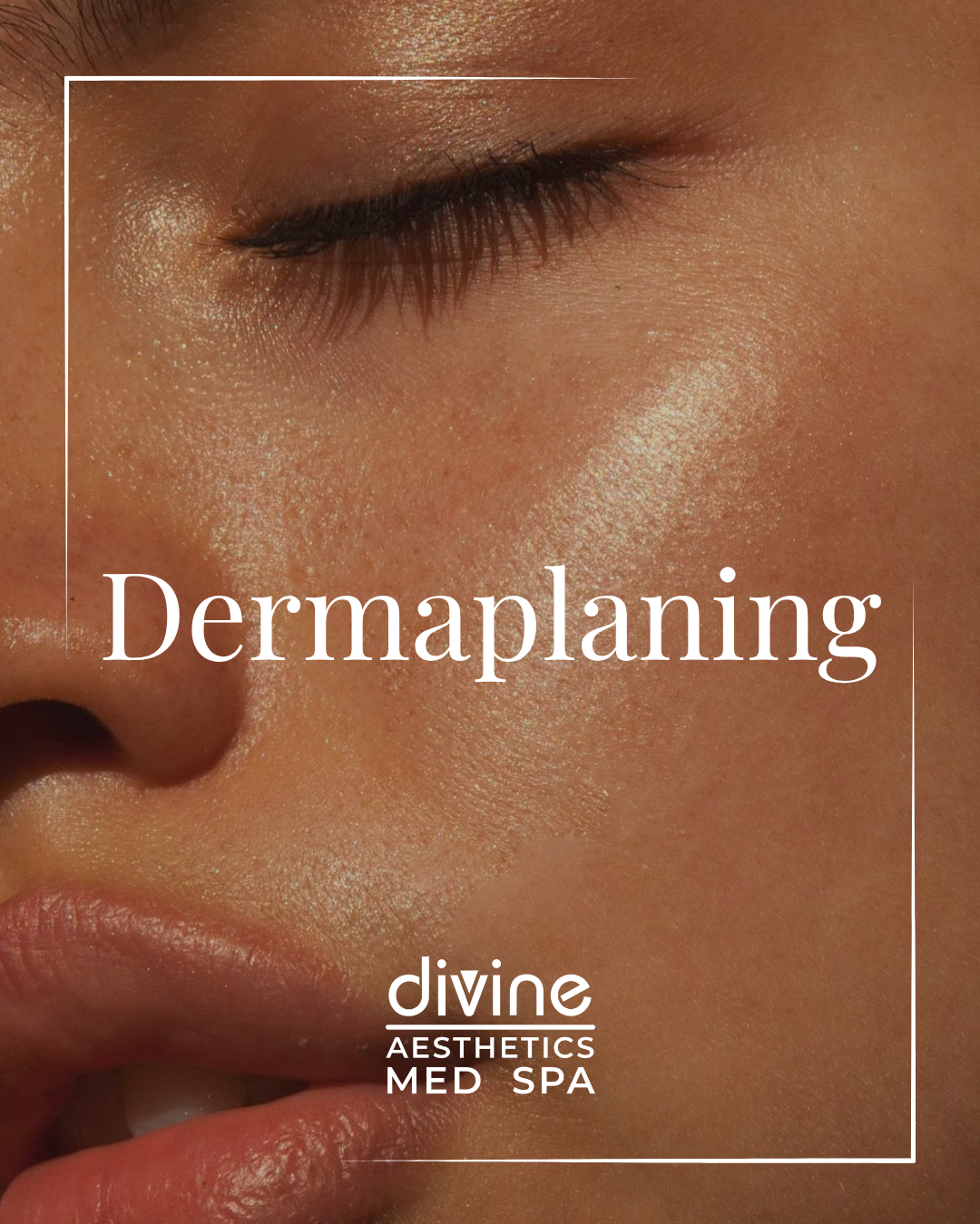 DERMAPLANING