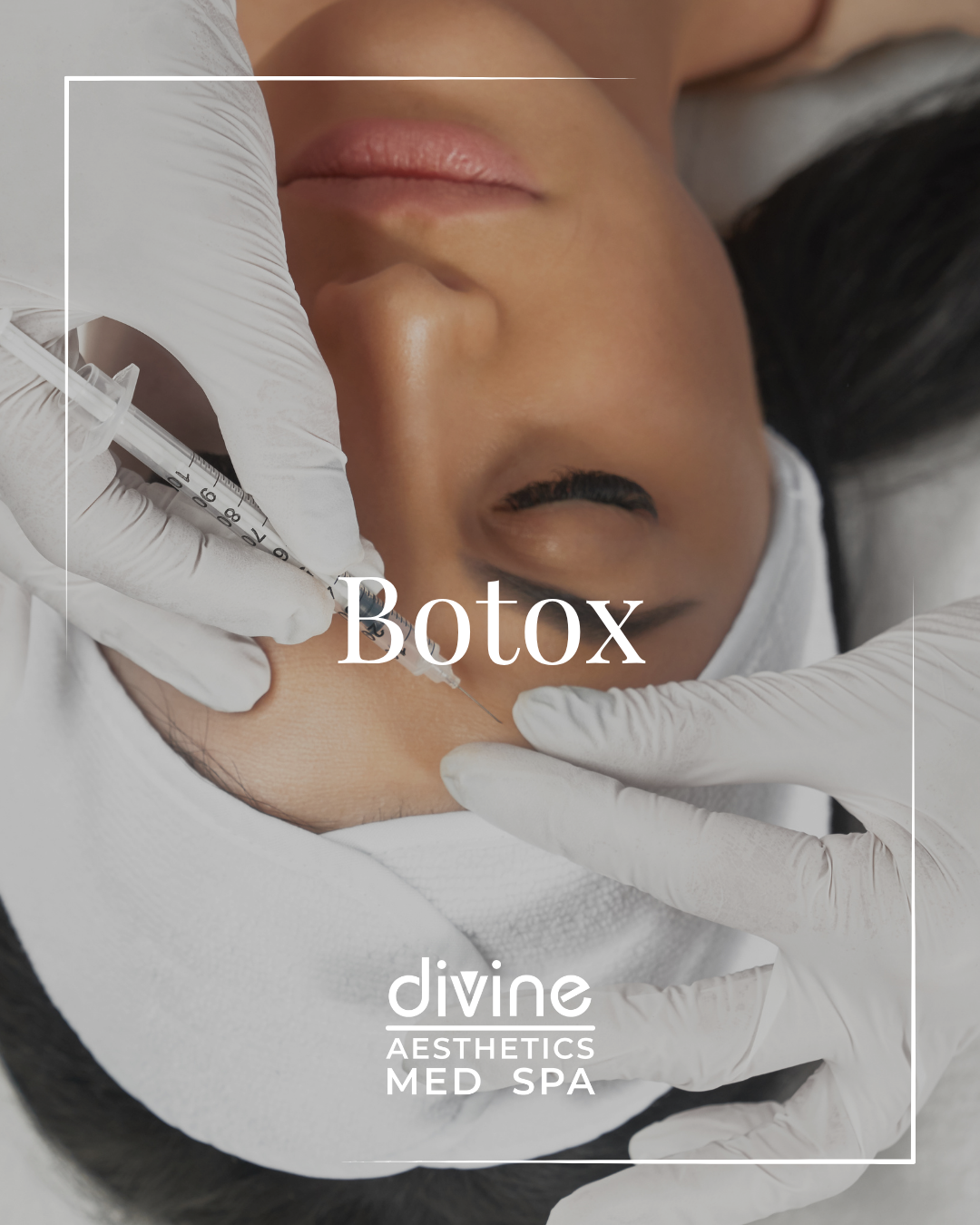 BOTOX 50U