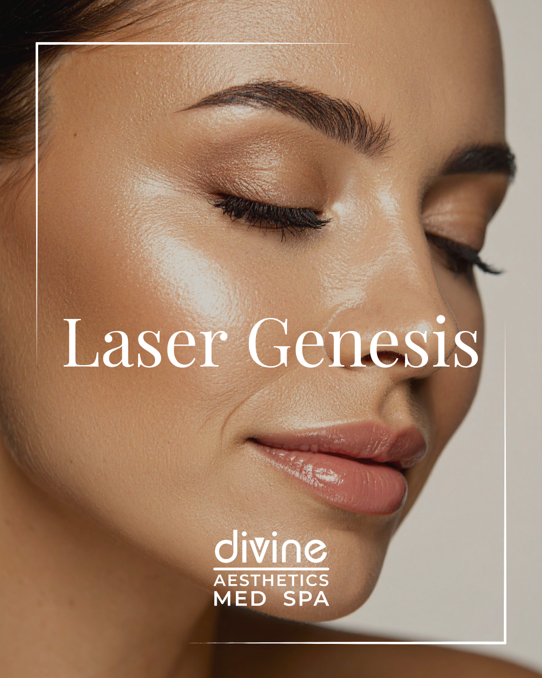 LASER GENESIS