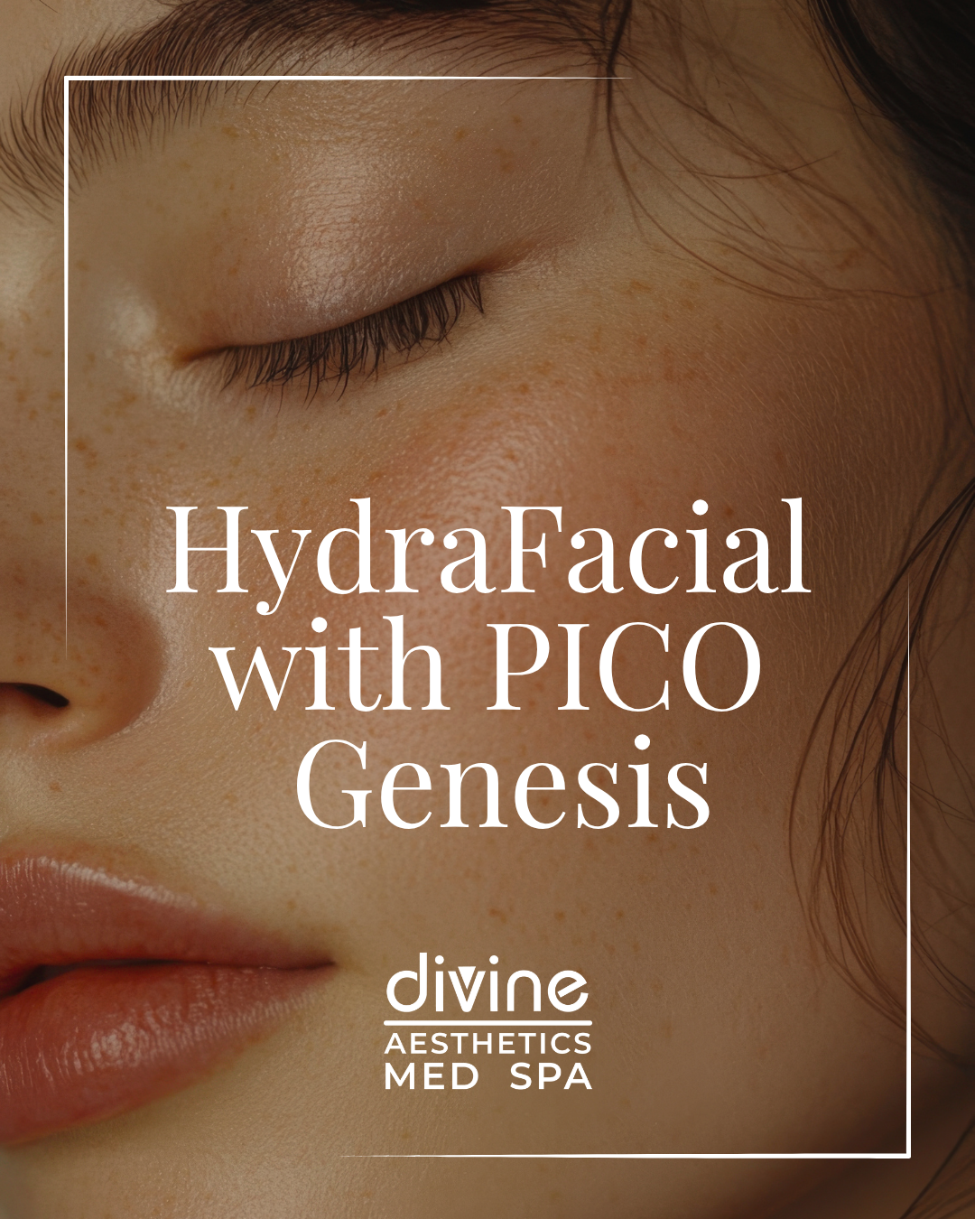 HYDRAFACIAL W/ PICO GENESIS