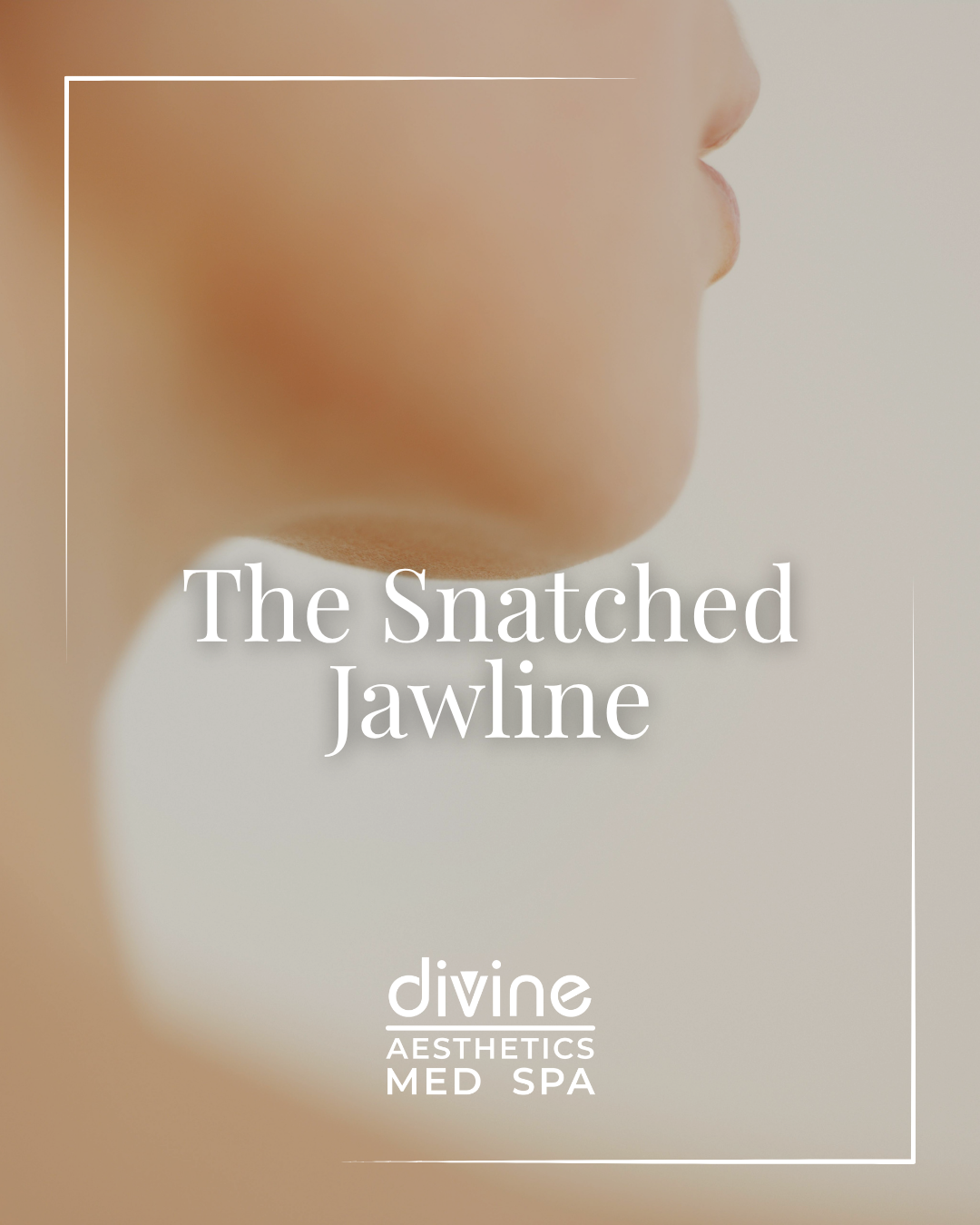 THE SNATCHED JAWLINE