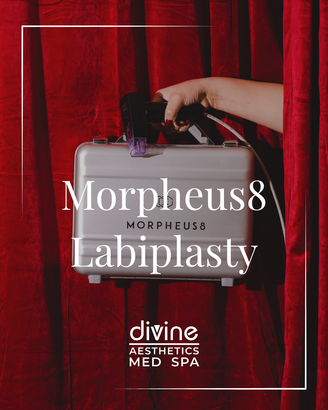 MORPHEUS8 LABIAPLASTY