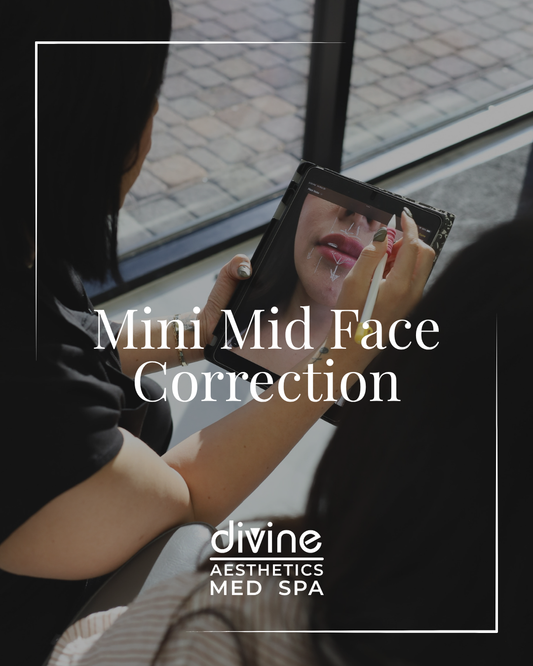 MINI MID FACE CORRECTION